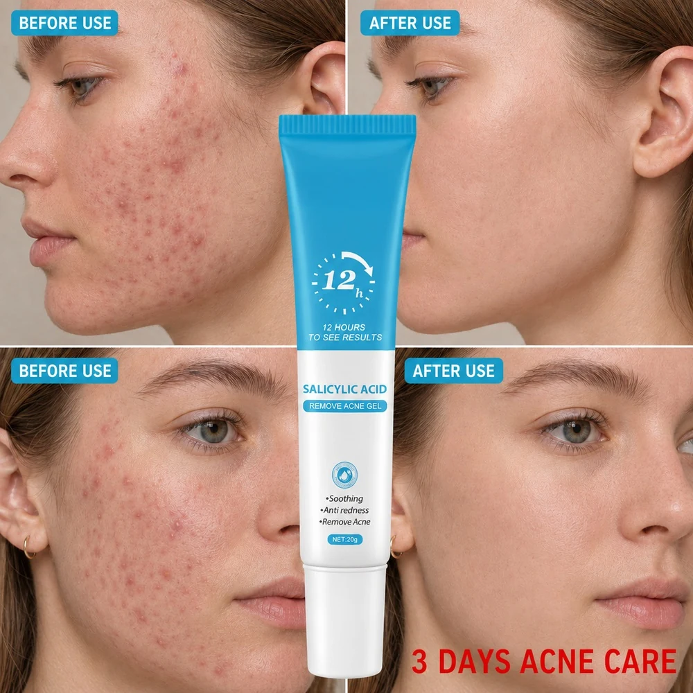 Collagen + Salicylic acid · Cream · FK-1601932312538